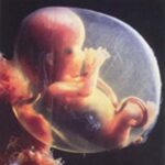 Embryo