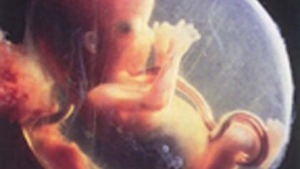 Embryo