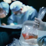 organ donations