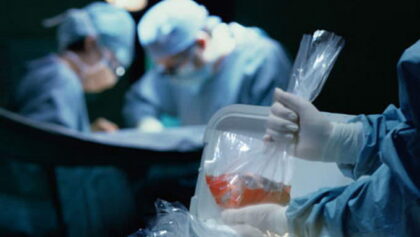 organ donations