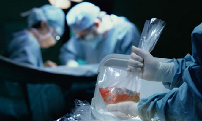 organ donations